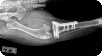 Tibial Plateau Leveling Osteotomy (TPLO)